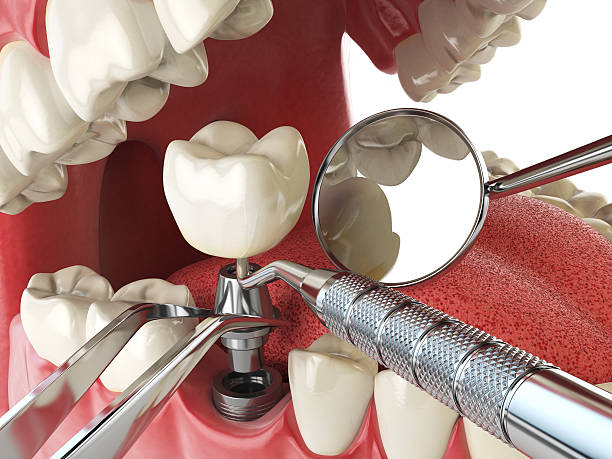 Best Emergency Treatment for Jaw Pain or Injury in Amarillo, TX